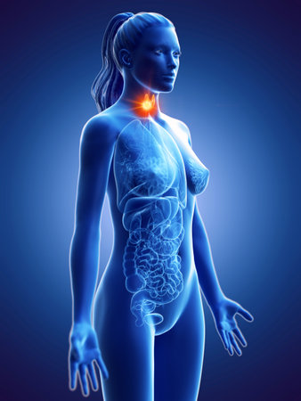 3d rendered medically accurate illustration of a womans thyroid gland cancer Stock Photo
