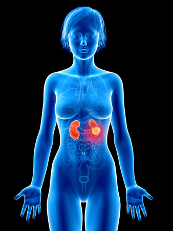 Medically accurate 3d rendering of a femaleâ´s kidneys cancer