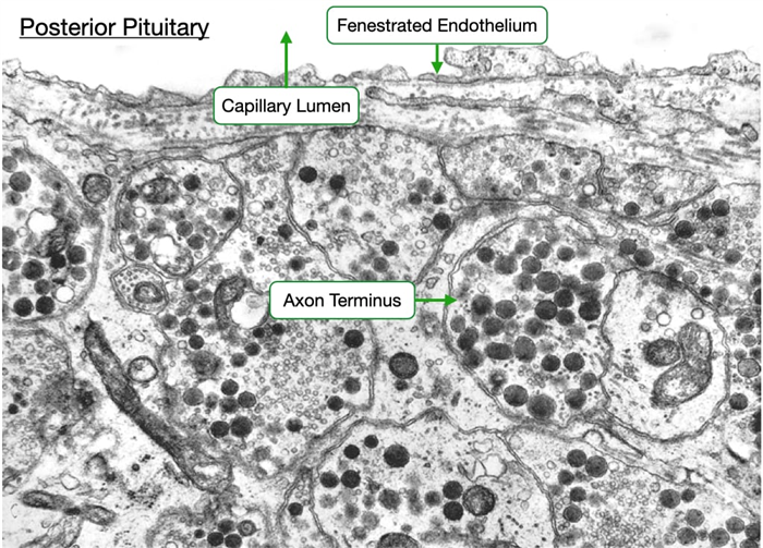Electron micrograph reveals axom termini and their proximity to fenestrated endothelium